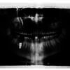 Foto X-Ray Tengkorak Kepala Hamish Daud