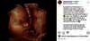 calon anak Audi Marissa  dan Anthony Xie