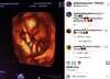 Penampakan calon buah hati Aurel dan Atta