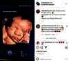 Bayi Atta dan Aurel Hermansyah