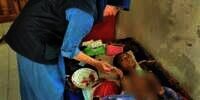 Kisah Pilu Syifa Bertahan Hidup Meski Tubuh Tinggal Tulang