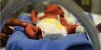 Waspadai 7 Penyebab Kelahiran Bayi Prematur