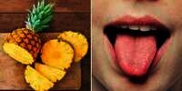 Penyebab Lidah Terasa Sakit dan Gatal Usai Makan Nanas