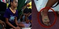 Pakai Sepatu 'Nike' dari Perban, Gadis Ini Menangkan 3 Medali Emas