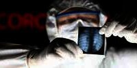 Begini Kondisi Tubuh Pasien yang Sembuh dari Virus Corona Covid-19
