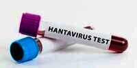 Muncul Lagi di China, Ini Cara Penularan Hantavirus serta Gejalanya