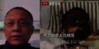 Dokter di Wuhan yang Kulitnya Jadi Hitam karena Covid-19 Meninggal Dunia