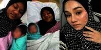 2 Kali Hamil, Wajah Mamah Muda Ini Berubah Hitam dan Teman Tak Mengenalinya