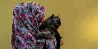 Mengenal Toxoplasma, Parasit Penyebab Radang Otak yang Diidap Barli Asmara