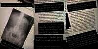 Heboh Wanita Pasang Ratusan Susuk, Terlihat Jelas Saat Foto X-ray