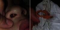 Hidung Anak Bau Busuk, Ibu Kaget Setengah Mati Saat Mengoreknya