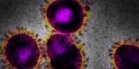 Hati-Hati! Wabah Virus Nipah Serang Malaysia, Ini Pemicu dan Efek Fatalnya