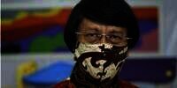 Kak Seto Mohon Doa, Kesehatan Menurun Didiagnosa Kanker Prostat
