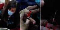 Bobot Naik 10 Kg, Damkar Sampai Turun Tangan Lepas Cincin Berlian Perempuan Ini