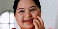 Gadis Down Syndrome Sukses Jadi Model Kecantikan