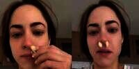 Viral Sumbat Hidung Pakai Bawang Putih untuk Redakan Sinusitis, Cek Faktanya!