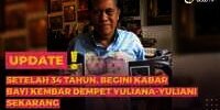 34 Tahun Berlalu, Ini Kabar Bayi Kembar Dempet Yuliana-Yuliani