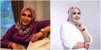 Potret Elly Sugigi Sebelum-Sesudah Perawatan, Melongo Lihatnya