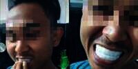 Termakan Iklan di TikTok, Gigi Putih Sempurna Suami Malah Bikin Istri Ngakak Guling-Guling