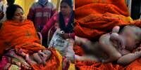 Bayi di India Lahir dengan 4 Tangan dan 4 Kaki, Warga Percaya Sebagai Titisan Dewa