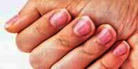Tips Mempercepat Pertumbuhan Kuku dengan Bahan Alami