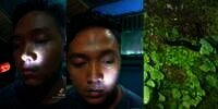 Ngeri! Pemuda Ini Tak Sadar Hidungnya Kemasukan Lintah Penghisap Darah, Netizen Salfok sama Ekspresinya yang Santuy