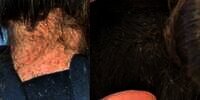 Bikin Bergidik! Penata Rambut Butuh 9 Jam Buat Hilangkan Kutu Rambut di Kepala Gadis Ini