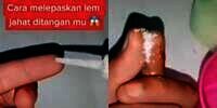 Tips Lepaskan Jari Lengket Kena Lem Super Kuat Ternyata Gampang Sekali, Cuma Pakai Garam dan Air