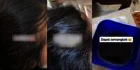Pemilik Salon Syok Lihat Kutu Rambut Menempel Kayak Butiran Beras, Cuma Disisir Dikit Langsung Dapat Semangkok