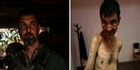 Viral Foto 'Before After' Tentara Ukraina yang Jadi Tawanan Perang Rusia, Sangat Menyedihkan Tinggal Tulang Dibalut Kulit