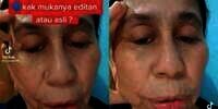 Idap Penyakit Langka, Wajah Wanita 28 Tahun Ini Berubah Seperti Wanita Usia 60 Tahunan