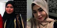 Ingat Wanita Berjerawat yang Dimodali Pacar Rp6,5 Juta Perminggu Agar Cantik? Begini Nasibnya Sekarang