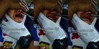 Orang Tua Panik Lihat Hidung Bocah Terselip Biji Kacang, Netizen Minim Empati Malah Nostalgia Masa Kecil