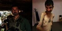 Viral Potret Diduga Tentara Ukraina dengan Badan Kurus Kering Usai Ditawan Rusia