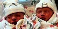 Bayi Kembar Lahir Jeda 5 Menit, Efeknya Jadi Beda Tahun 