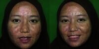 Wanita Penuh Jerawat Meradang & Bopeng Dirias MUA Jadi Pengantin, Hasilnya Bikin Kaget!