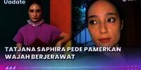 Tatjana Saphira Pede Pamerkan Wajah Berjerawat