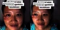 Potret Makeup Pengantin Usai Alami Kecelakaan, Hasilnya Malah di Luar Dugaan, MUA Auto Panik!