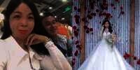 Gadis Berwajah Rusak Cari Jodoh di Facebook, Tak Disangka Ada Pria Tertarik, 1 Bulan Pacaran Langsung Menikah