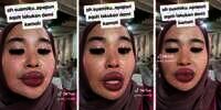 Ngakak! Wanita Ini Rela 'Operasi Plastik' Bikin Bibir Tebal Kayak Barbel Biar Suami Nggak Ngelirik Sana-sini
