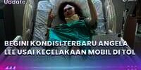 Alami Kecelakaan Mobil, Kondisi Angela Lee Memprihatinkan