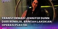 Transformasi Jennifer Dunn dari Remaja, Bantah Lakukan Operasi Plastik