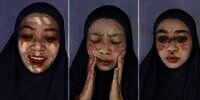 Transformasi Wajah Cewek Mirip Badut Jadi Cantik Glowing, Sampai Dikira Beda Orang