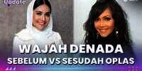 Wajah Denada Sebelum VS Sesudah Oplas