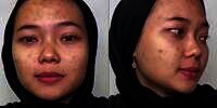 Wajah Pengantin Penuh Jerawat Ini Seketika Berubah Drastis Usai Dirias MUA, Ternyata Begini Hasilnya&hellip;