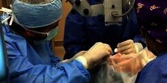 Operasi Dokter Keluarkan Cacing Seukuran Ular dari Mata Wanita