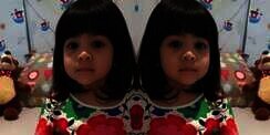 Detik-detik Perjuangan Balita Cantik Ashira Melawan Tumor