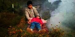 Tak Punya Biaya Berobat, Ayah `Bakar` Anak