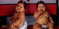 Usia Belum Setahun, Bayi Ini Berbobot 20 Kilogram