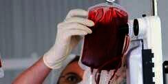 Rumah Sakit Ini Transfusikan Darah Bervirus HIV ke Pasien